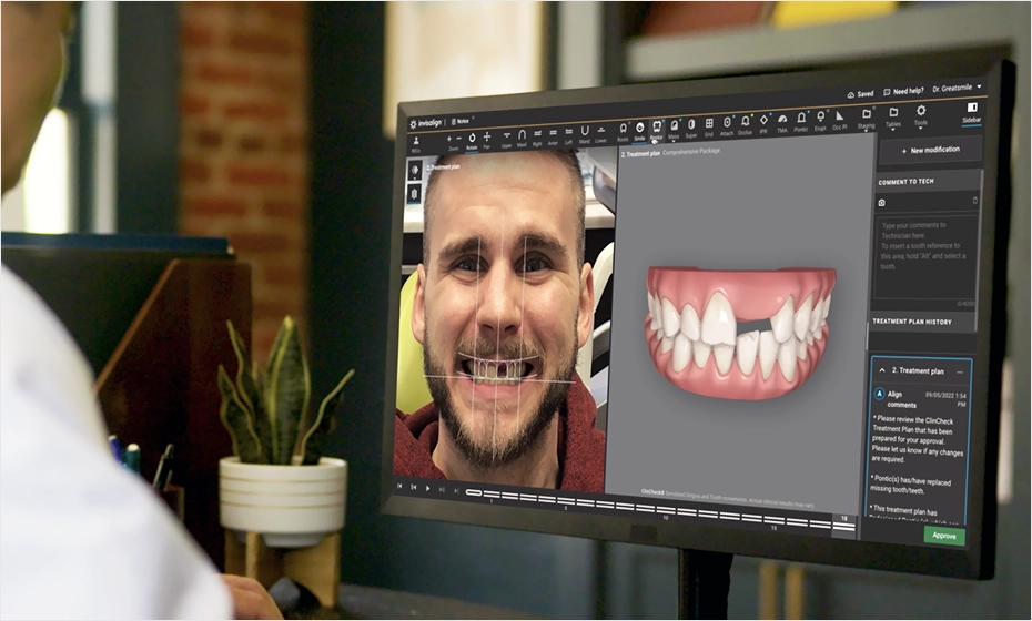 Dijital Gülüş Tasarımı