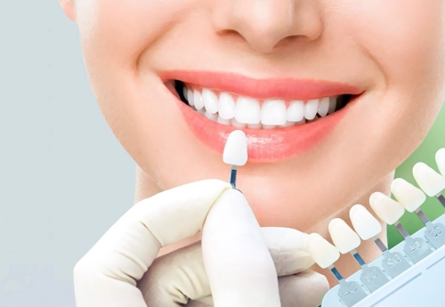 Emax Lamine Diş Kaplama