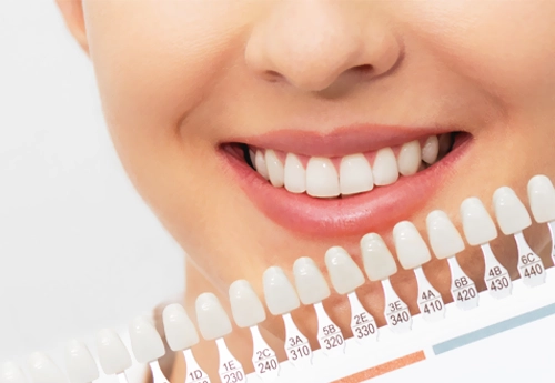 Zirkonyum Diş Kaplama Ankara